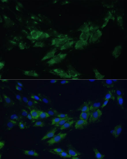 EPHA4 Rabbit Polyclonal Antibody