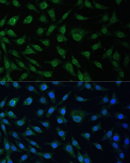 NUP214 Rabbit Polyclonal Antibody