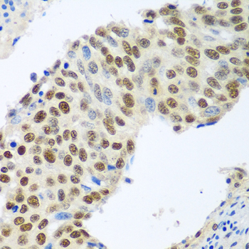 MDC1 Rabbit Polyclonal Antibody