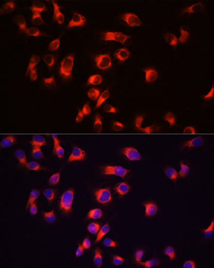MAPT antibody