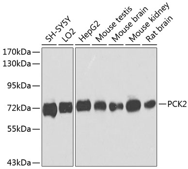 PCK2 Rabbit Polyclonal Antibody