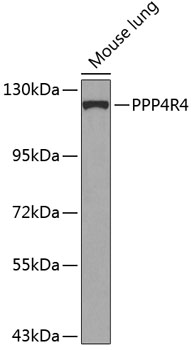 PPP4R4 Polyclonal Antibody