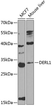 DERL1 Polyclonal Antibody