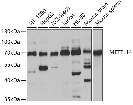 METTL14 Polyclonal Antibody