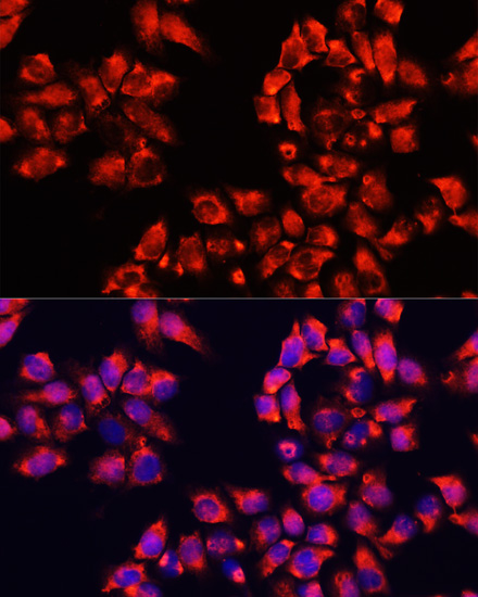 ALDH7A1 Rabbit Polyclonal Antibody