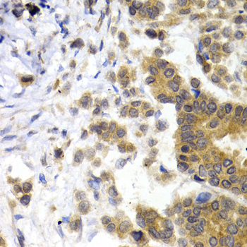 NEFL antibody