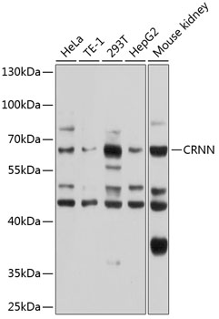 CRNN Polyclonal Antibody