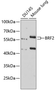 BRF2 Rabbit Polyclonal Antibody