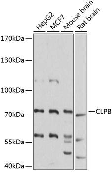 CLPB Polyclonal Antibody