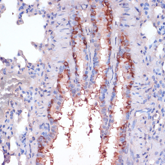 RPL22 Rabbit Polyclonal Antibody