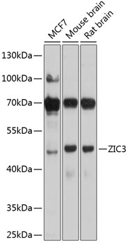 ZIC3 Rabbit Polyclonal Antibody