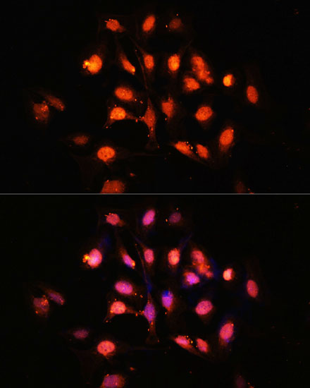 PHLPP1 Rabbit Polyclonal Antibody