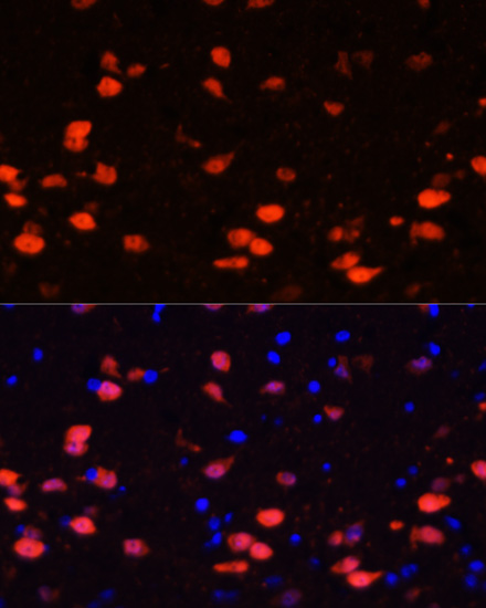 CALB2 Rabbit Polyclonal Antibody