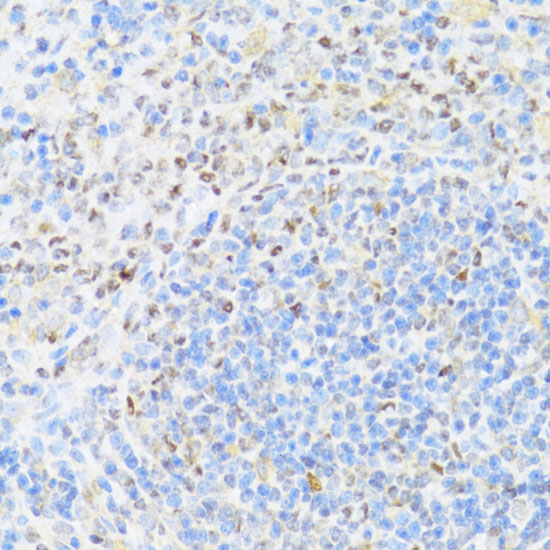UQCC2 Rabbit Polyclonal Antibody