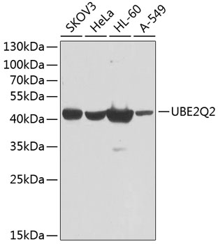 UBE2Q2 Rabbit Polyclonal Antibody