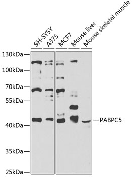 PABPC5 Rabbit Polyclonal Antibody