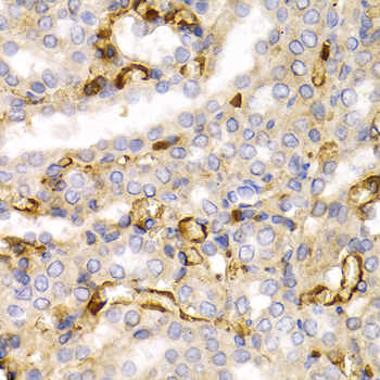 NEFL antibody
