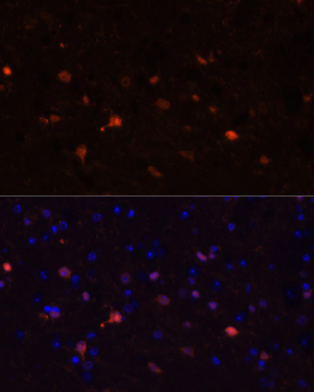 S100B antibody