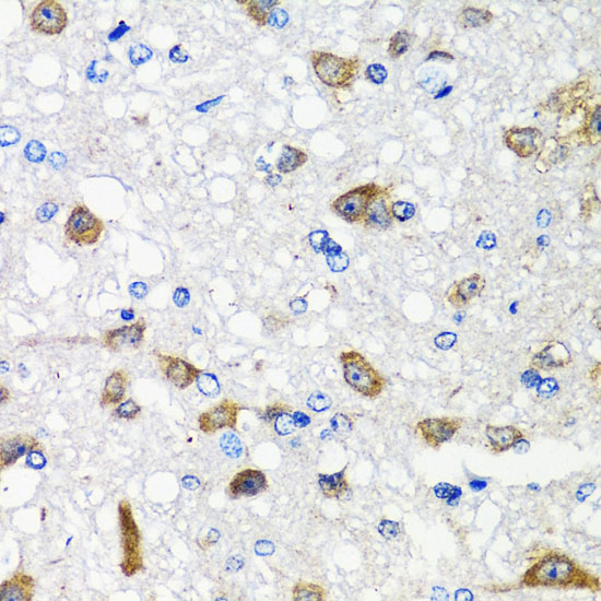 ACVR1C antibody