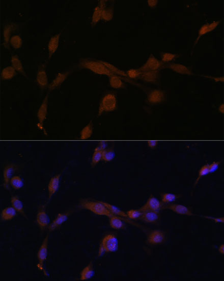 ATG7 antibody