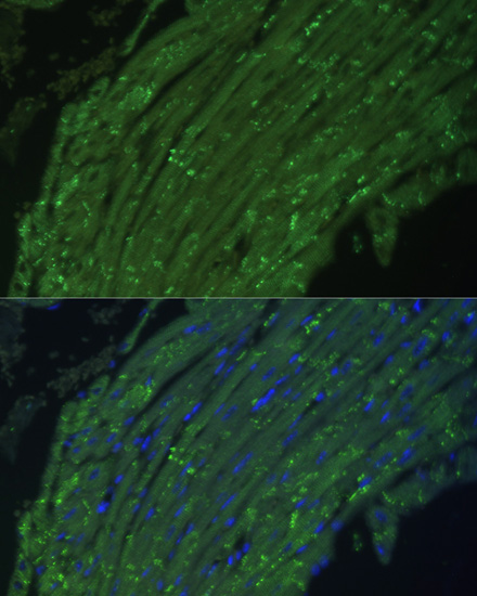 DES antibody
