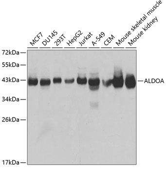 ALDOA Antibody