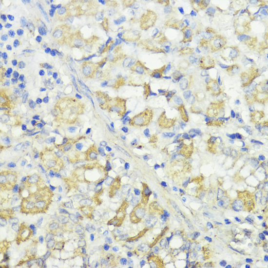 CTSB antibody