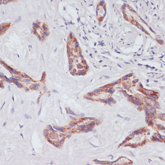 RAP1A antibody