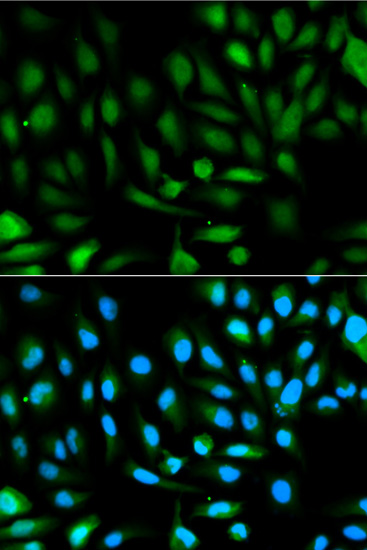 PARK7 Antibody