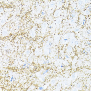 CNP antibody