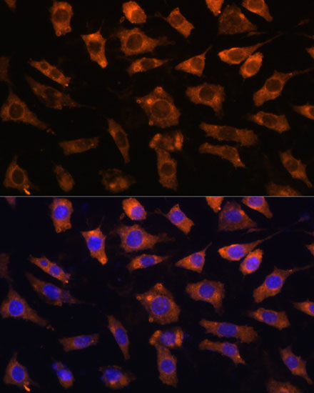 CYR61 antibody