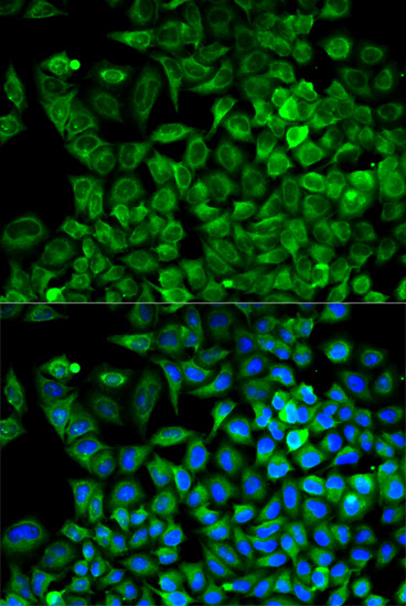 ALDOA Antibody