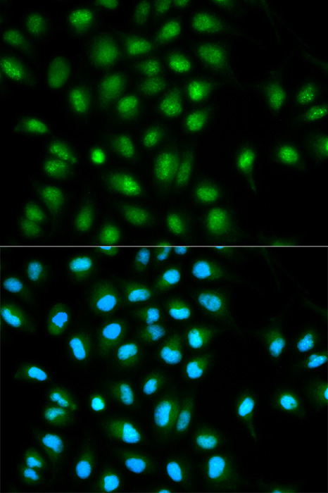 PYCARD Antibody