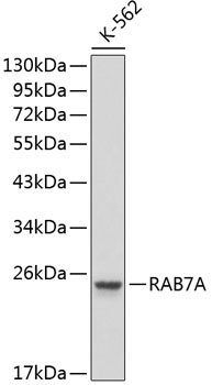 RAB7A antibody