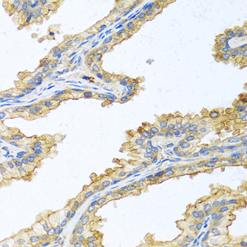 PRSS1 antibody