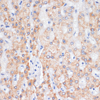 DBI Polyclonal Antibody