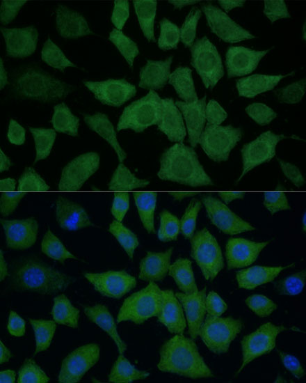 IDH1 Polyclonal Antibody