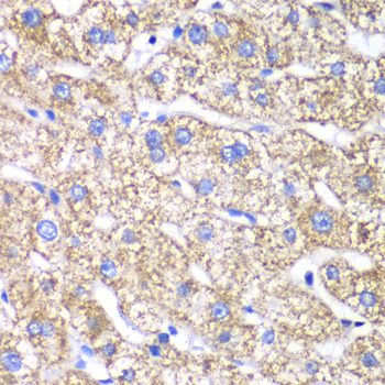DLST Polyclonal Antibody