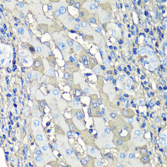 ALB antibody