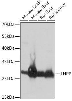LHPP Polyclonal Antibody