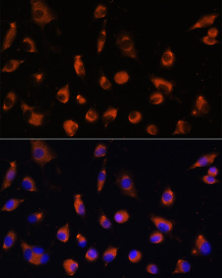 TMEM25 Polyclonal Antibody