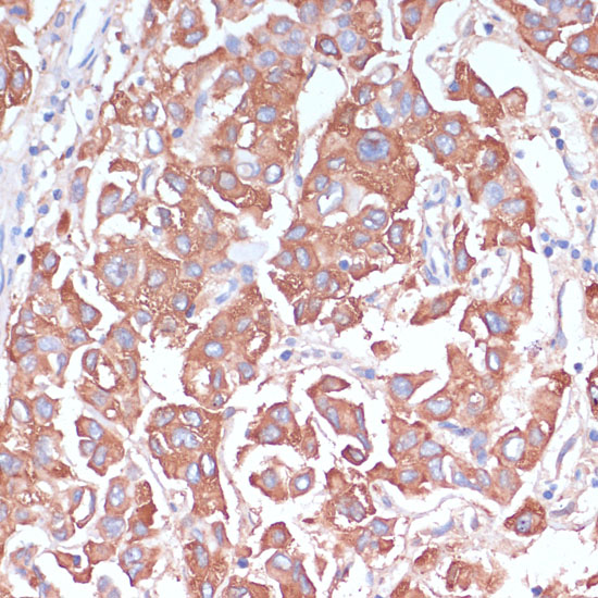 LRP1 antibody