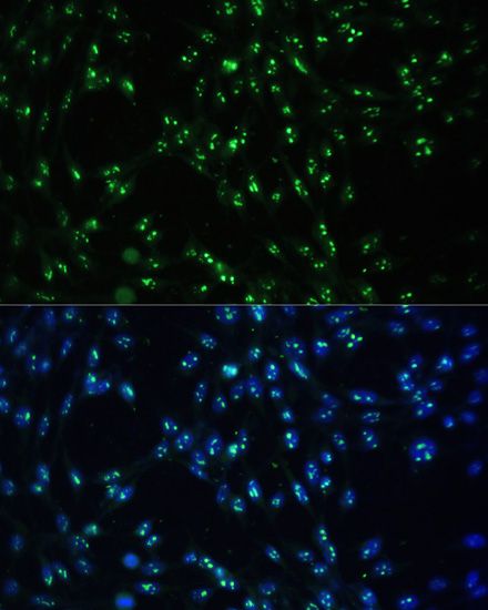 CCDC59 Polyclonal Antibody