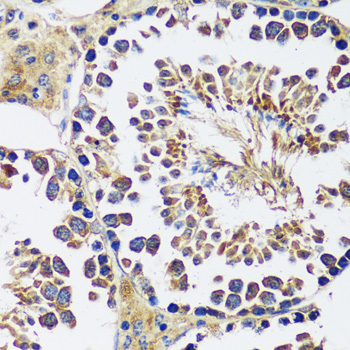 CCDC124 Polyclonal Antibody