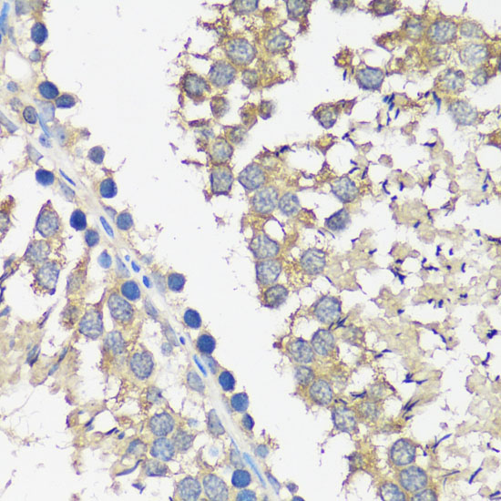 ASZ1 Polyclonal Antibody