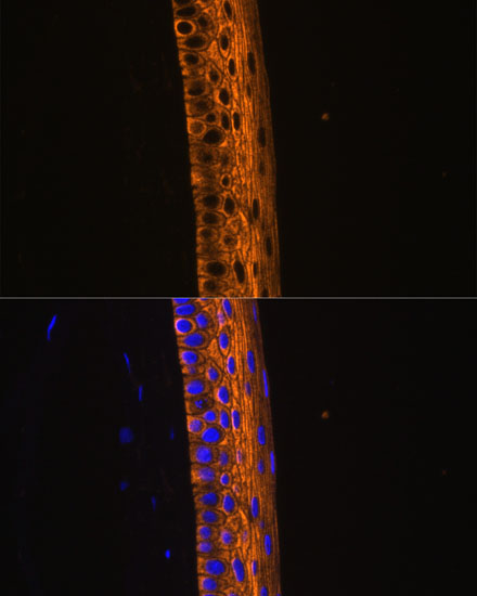MYH13 Polyclonal Antibody