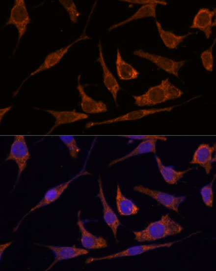 RPE Polyclonal Antibody