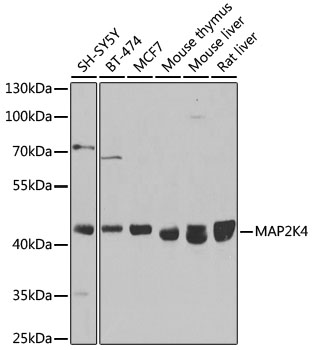 MAP2K4 Polyclonal Antibody