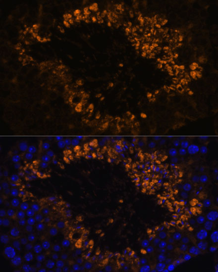 OXCT2 Polyclonal Antibody