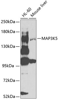 MAP3K5 antibody